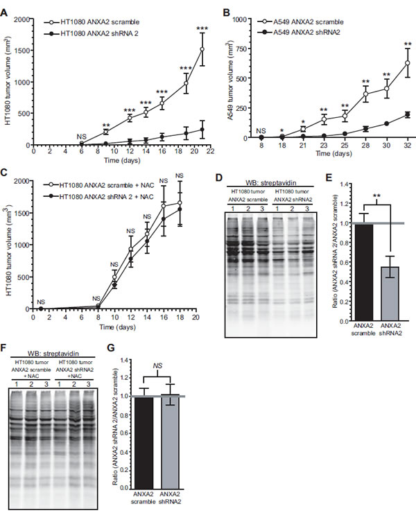 ANXA2 redox regulatory function plays a role in tumorigenesis.