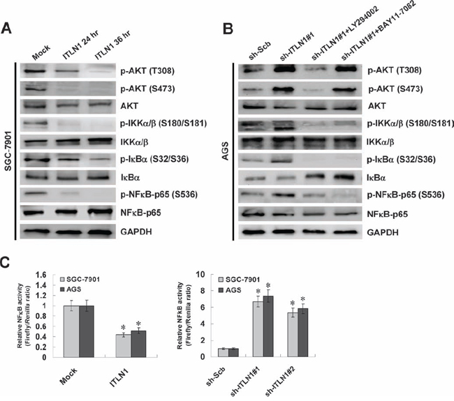 ITLN1 attenuated the NF&#x03BA;B activity via inactivation of PI3K/AKT/IKK signaling in gastric cancer cells.