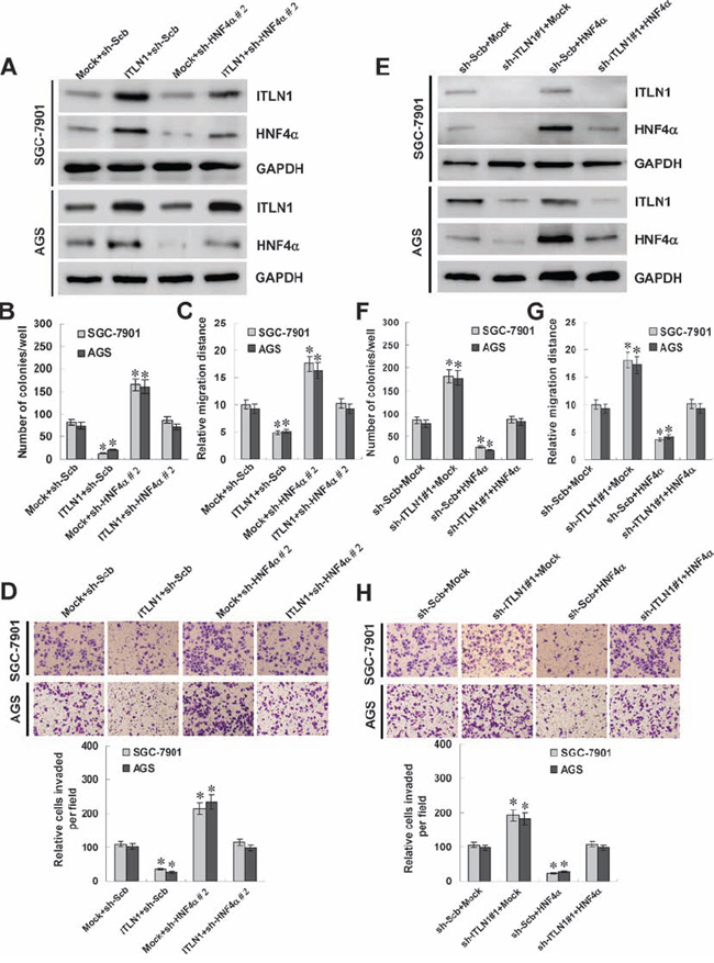 ITLN1 suppressed the growth, migration, and invasion of gastric cancer cells in vitro through up-regulating HNF4&#x03B1;.