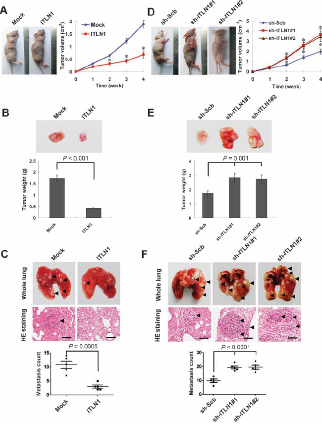 ITLN1 attenuated the growth and metastasis of gastric cancer cells in vivo.