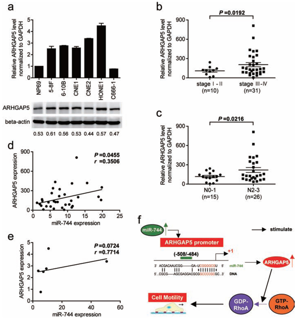 ARHGAP5 expression is upregulated in NPC cell lines and associated with tumor progression as well as miR-744 expression in NPC clinical specimens.