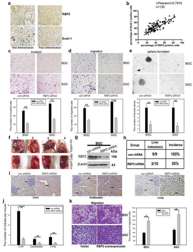 RBP2 expression was positively correlated with differentiation status and distant metastasis in primary gastric cancer tissues and it is involved in GC progression and GC stemness property maintenance.