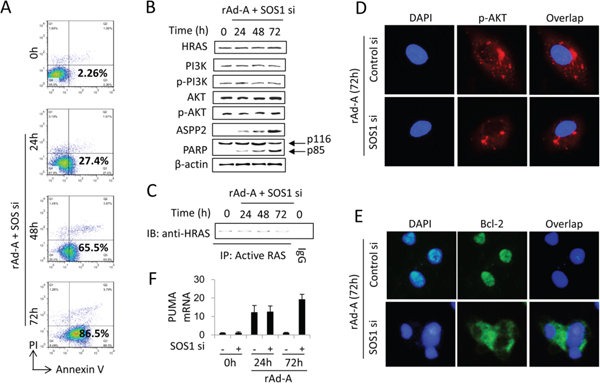 SOS1 expression is critical for activating the HRAS/PI3K/AKT pathway and maintaining nuclear translocation of p-AKT and Bcl-2.