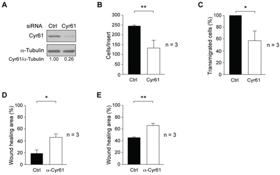 Effect of Cyr61 suppression or antibody neutralization on breast cancer cell motility properties.
