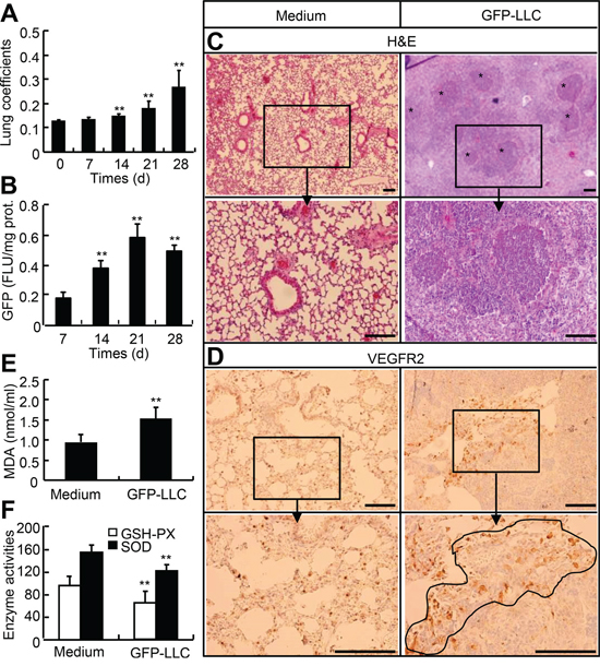 Mouse model with hematogenous metastasis of LLC to lung.