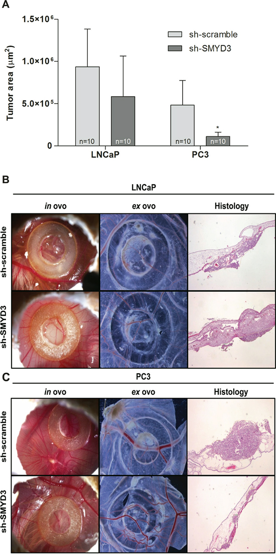 In vivo effect of SMYD3 silencing in tumor formation and angiogenesis in PCa cell lines.