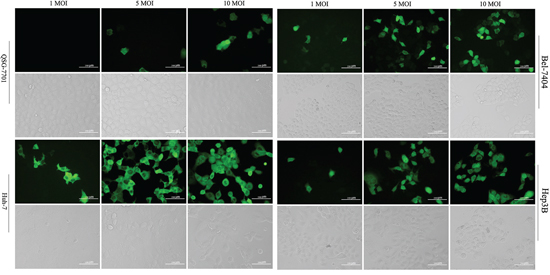 Tumor-specific EGFP expression driven by the GOLPH2 promoter.