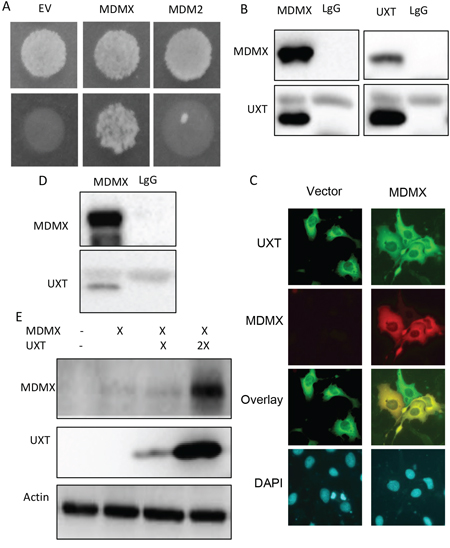 UXT binds to and stabilizes MDMX.