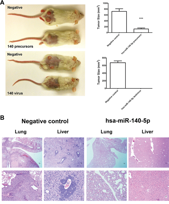 Hsa-miR-140-5p impacts CRC initiation and metastasis in vivo.