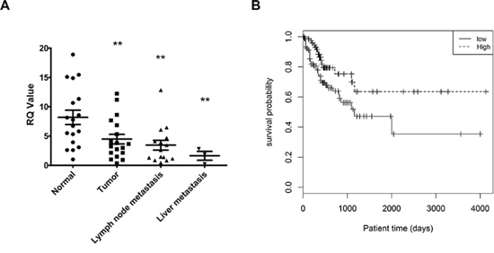 The expression level of hsa-miR-140-5p is significantly correlated with CRC patients survival.