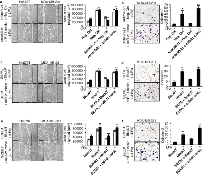 LPA-induced cell migration and invasion depend on miR-21 activity down-stream activation of LPA1 and ZEB1.