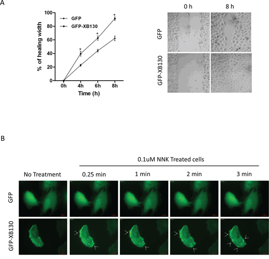 Overexpression of XB130 enhances BEAS2B cell migration. BEAS2B cells were stably transfected with GFP-XB130 or GFP alone.