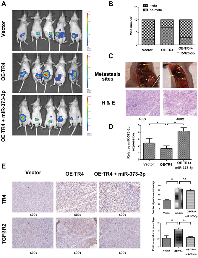 TR4 promotes metastasis of PCa via miR-373-3p in vivo.
