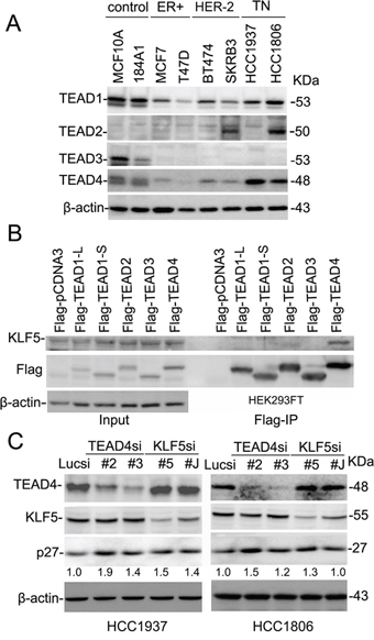 TEAD4 interacts with KLF5 and suppresses the p27 gene expression in TNBC cell lines.