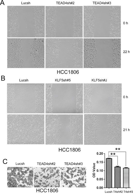 TEAD4 and KLF5 promote cell migration in HCC1806 cells.
