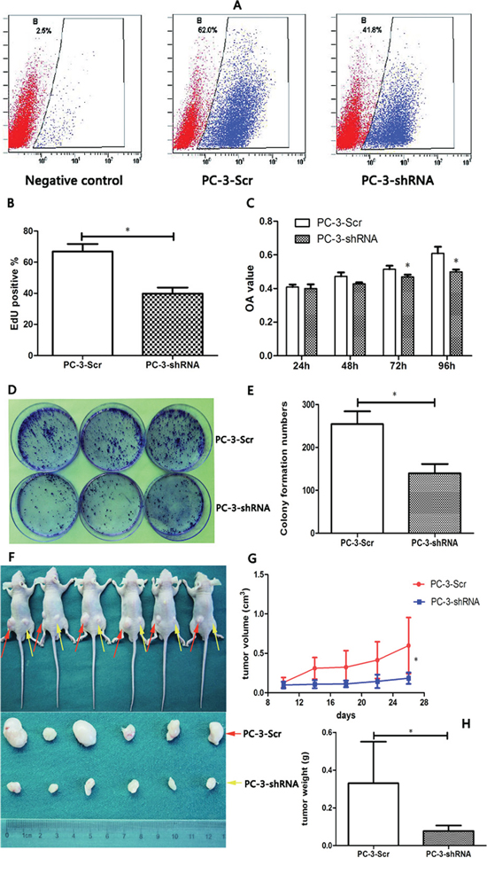TREK-1 knockdown significantly inhibits cell proliferation in PCa cells in vitro and in vivo.