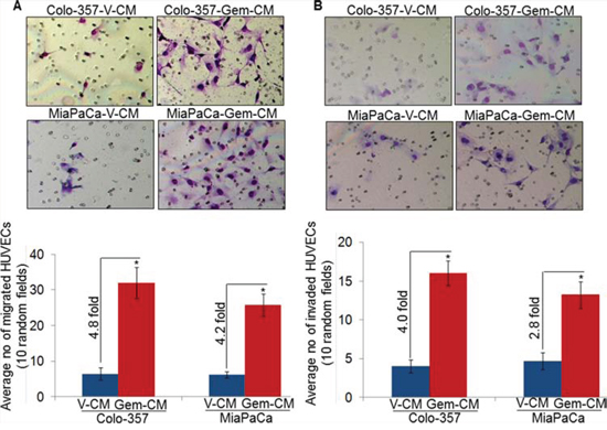 Conditioned media from gemcitabine-treated pancreatic cancer cells promotes motility and invasion of endothelial cells.