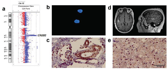 Various clinically viable approaches to measure ERBB2 in metastatic and primary tumors from a single patient both verify results and reveal complexities in interpreting outcomes.