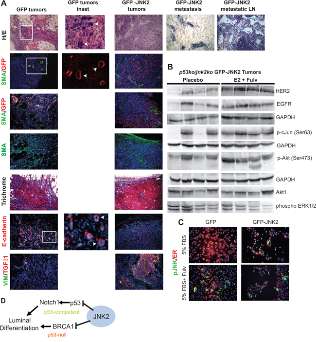 Histologic and western blot analysis of GFP and GFP-JNK2 tumors.