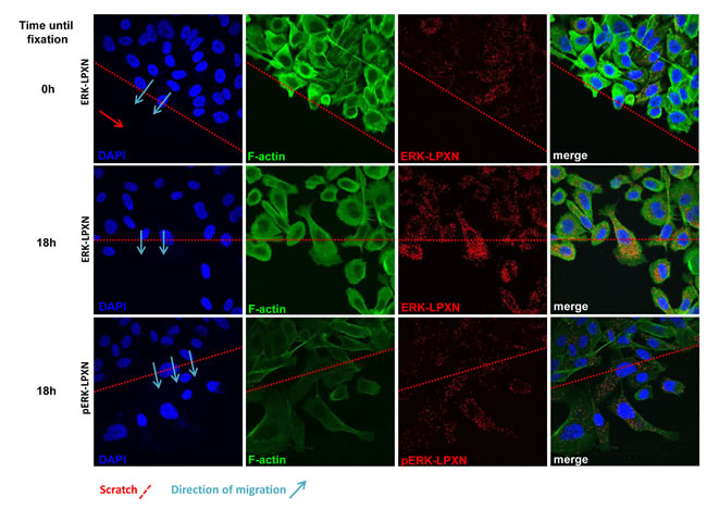 Interaction of ERK and LPXN during PCa cell migration.