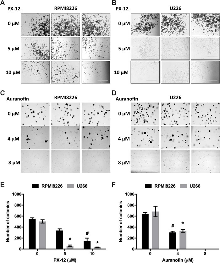 Inhibition of Trx1 or TrxR1 decreases clonogenic activity of MM cells.
