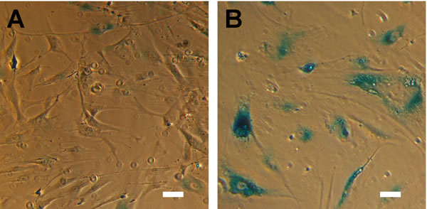 HTM cells exhibit hallmarks of senescence at advanced passage.