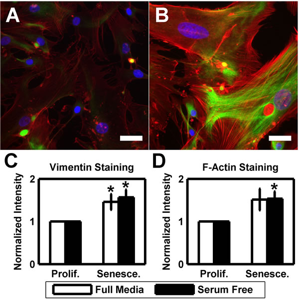 HTM cells exhibit more pronounced cytoskeleton at senescence.