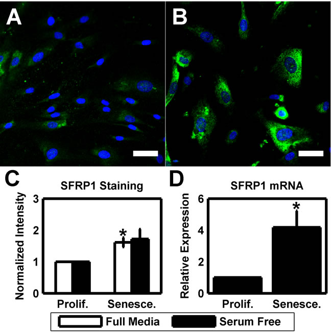 Elevated SFRP1 expression is a phenotype of HTM senescence.