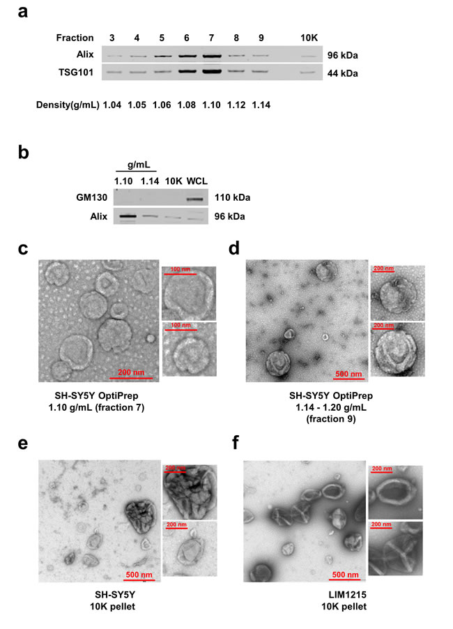 Isolation and characterization of EVs.