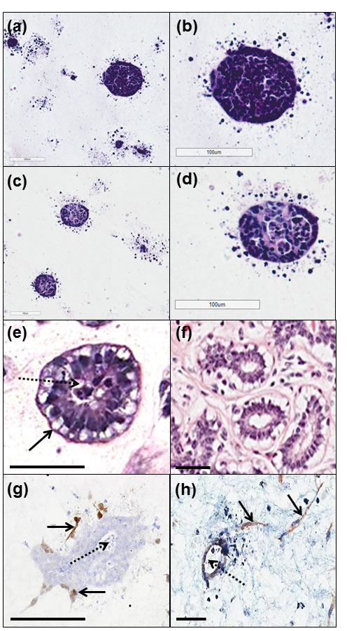 Comparison of morphology of 3D tri-culture model with normal human breast tissue.