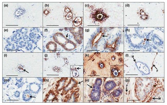 Comparison of immunohistochemical profiles of 3D tri-cultures with those of normal breast tissue.