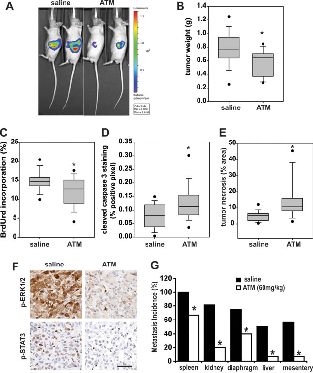 ATM inhibits Panc-1 tumor size and aPKC signaling pathways
