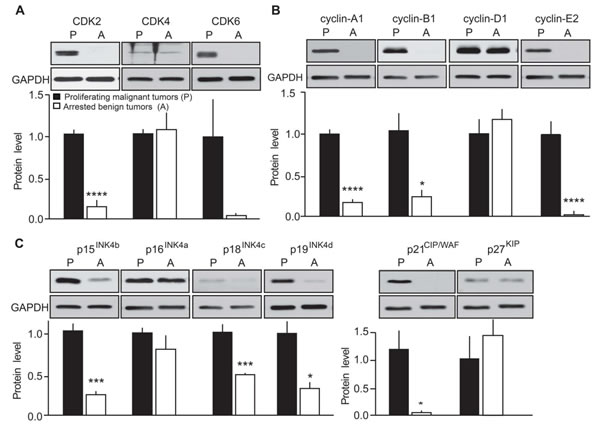 Evaluation of the effects of p25-GFP overexpression on cell cycle protein expression in malignant versus benign mouse MTC.