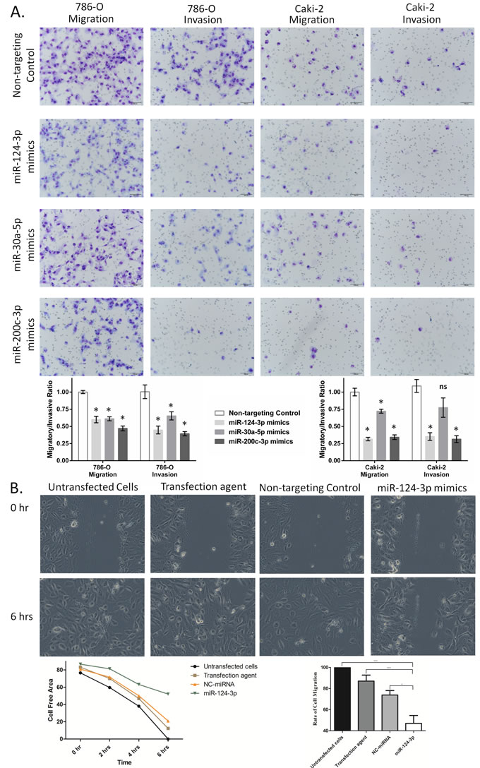 miR-124-3p, -30a-5p and -200c-3p effect on migration and invasion of kidney cancer cell lines.