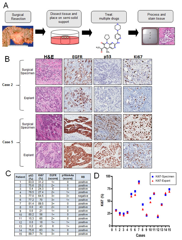 Primary tumor explants recapitulate multiple biological features of the disease: A.