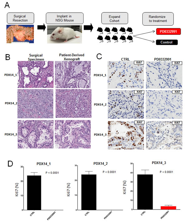 Patient-derived xenografts recapitulate primary tumor and demonstrate significant vulnerability to CDK4/6 inhibition: A.