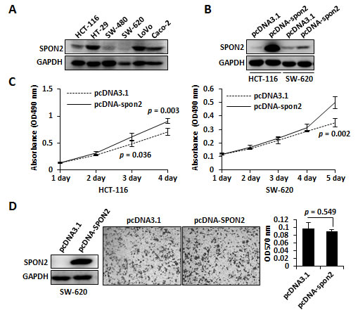 The functional role of SPON2 in colon cancer cell lines.