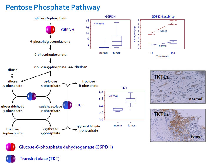 Glucose-6-phosphate dehydrogenase (G6PDH) and transketolase (TKT) are over-expressed in ccRCC.