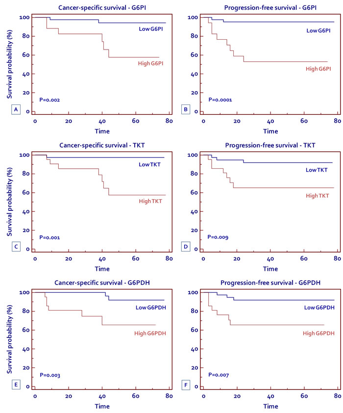 Kaplan-Meier cancer-specific survival (CSS) and progression-free survival (PFS) curves, stratified by G6PI (A, B) TKT (C, D) and G6PDH (E, F) tissue levels.