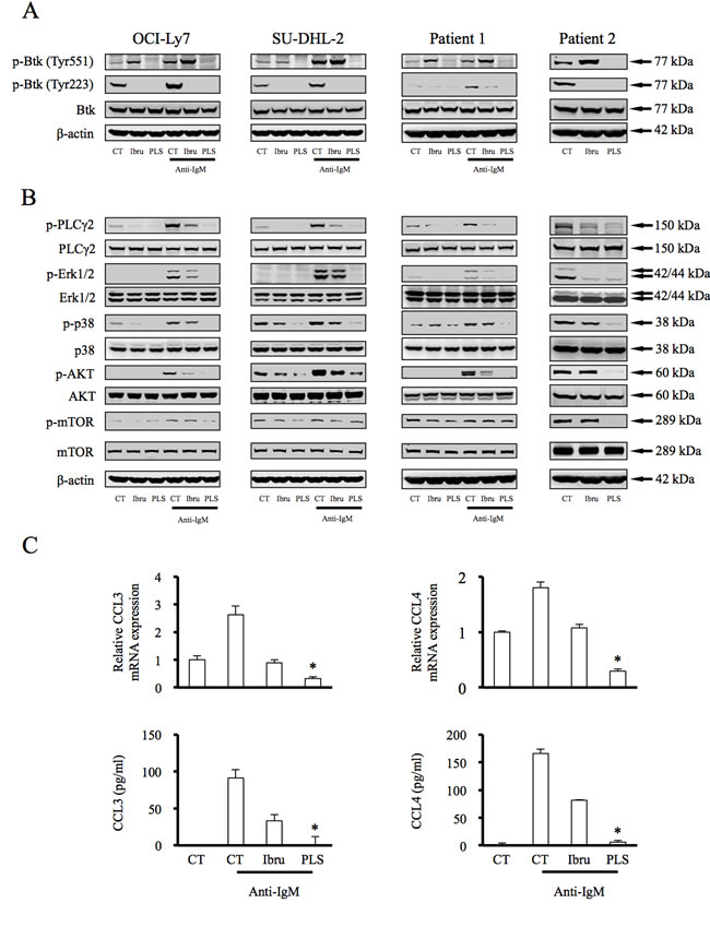 PLS-123 precisely regulates the activation and catalytic properties of Btk, and results in greater attenuation of the BCR activating pathway than ibrutinib.