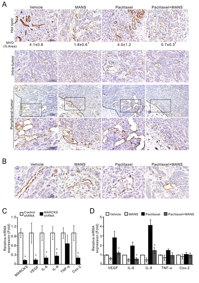 Suppression of phospho-MARCKS reduces microvessel density and the expression of angiogenic factors in TNBC cells.