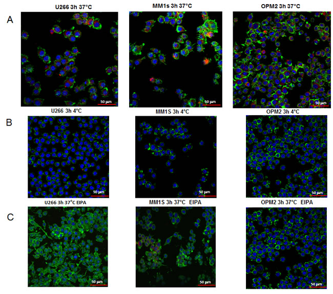 Uptake of multiple myeloma cell-derived exosomes by osteoclasts precursors.