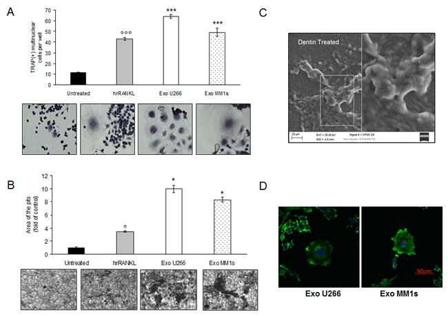 Exosomes produced by multiple myeloma cells induce osteoclast formation in RAW 264.7 cells and promote formation of lacunae on dentine slices.