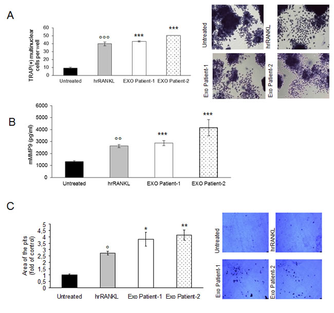 Exosomes in plasma of patients with multiple myeloma promote osteoclasts differentiation from Raw264.7 precursors and regulate bone resorption activity of osteoclasts.