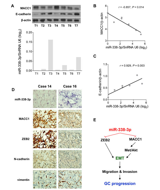 The EMT suppressive effect induced by miR-338-3p is confirmed in GC tissues.