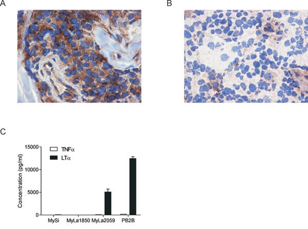 LT&#x3b1; expression in CTCL.