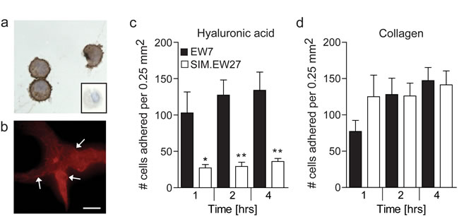 Aggressive Ewing sarcoma cells show membranous CD44 expression and gain increased adherence to the CD44 ligand hyaluronic acid.