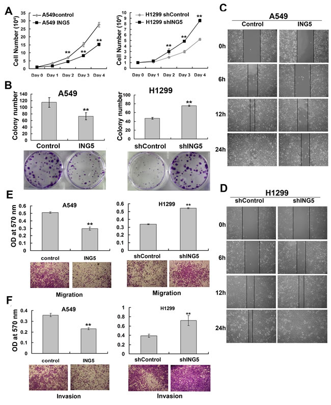 ING5 inhibits lung cancer proliferation, migration and invasion.