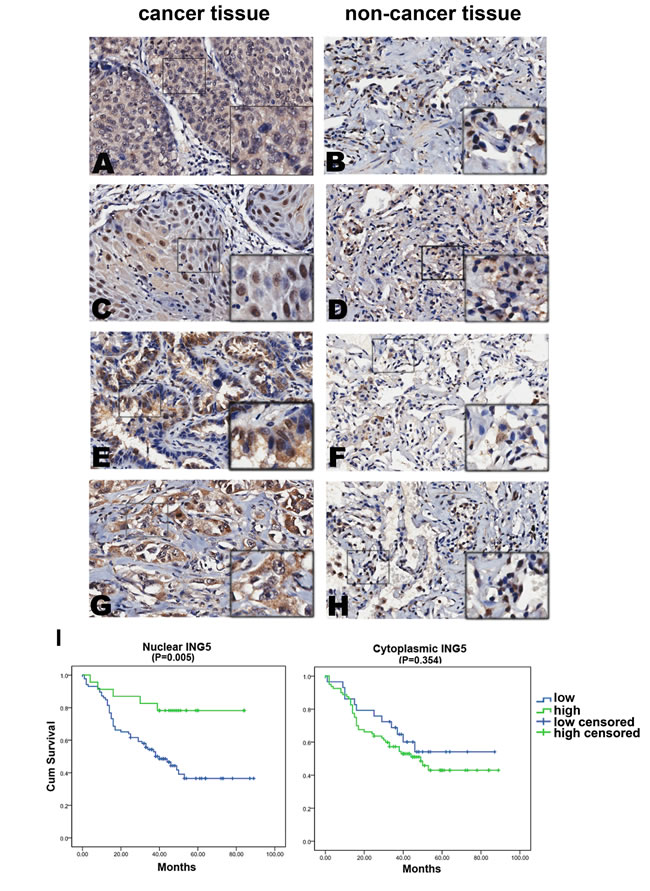 Nuclear ING5 in lung cancer tissues negatively correlates with clinical stages and lymphnode metastasis, and positively correlates with a better survival of lung cancer patients.