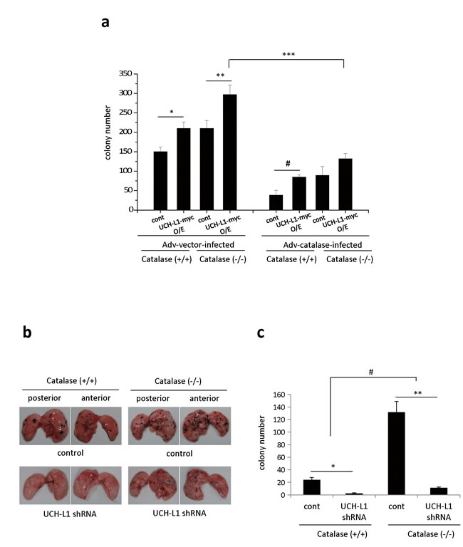 UCH-L1 is involved in H